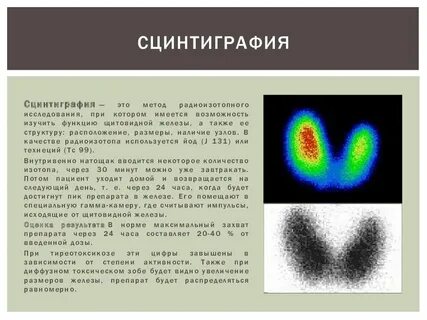 Стенография щитовидной железы
