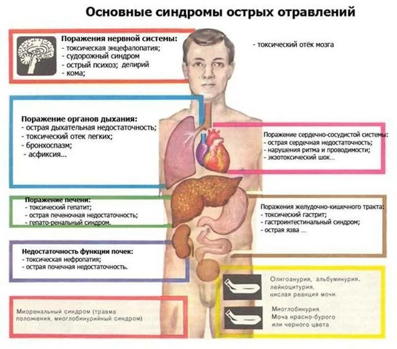 Отравление всего организма вызывают какие вещества. Симптомы отравления. острое отравление. острое отравление симптомы. признаки острого отравления.