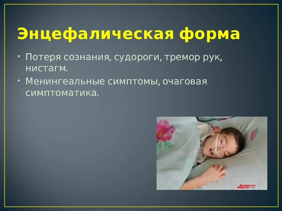 Потеря сознания спазмы