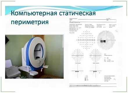 Периметрия что это такое в офтальмологии