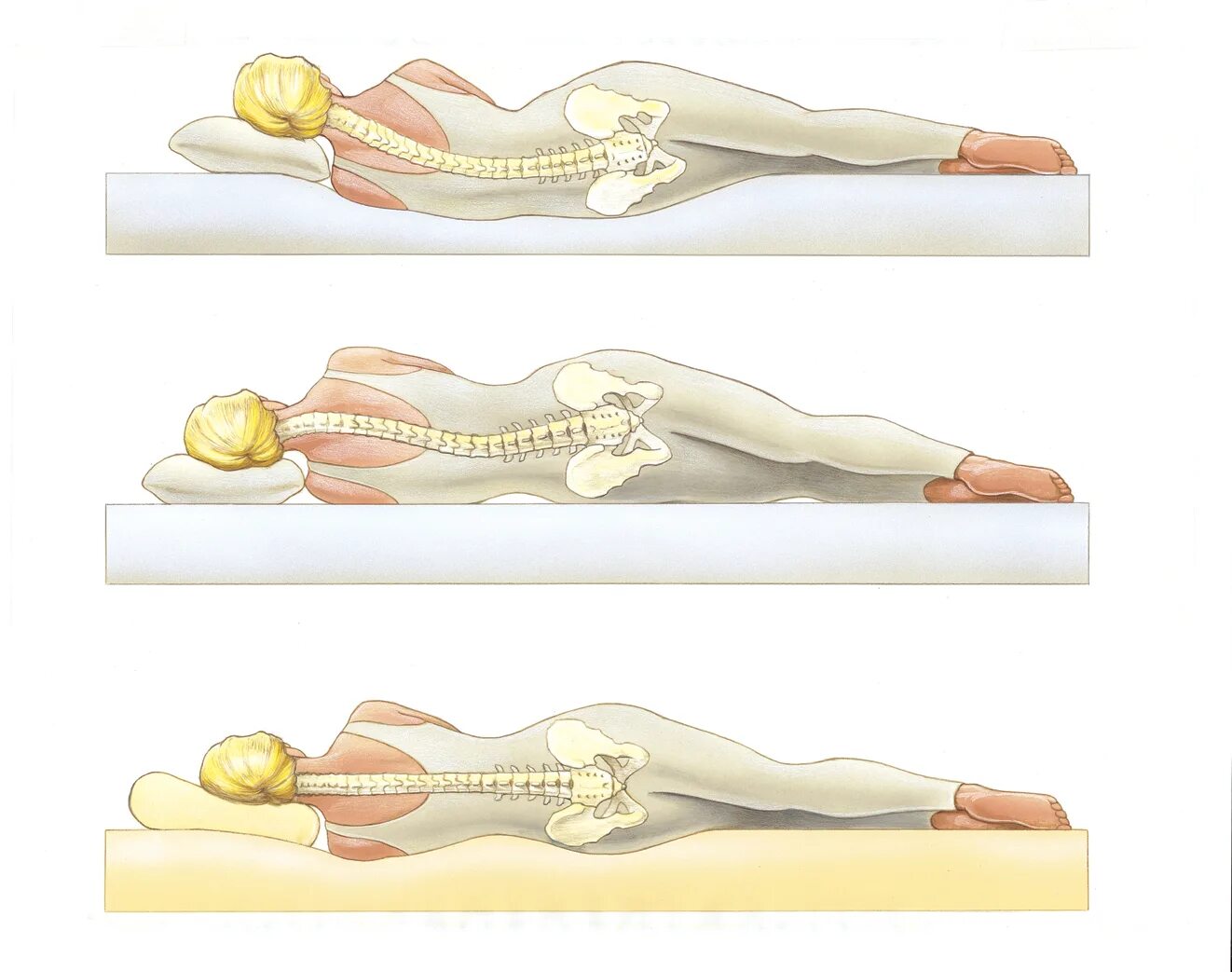 Положение позвоночника лежа на спине. Ортопедический матрас позвоночник. Правильный ортопедический матрас. Правильный матрас для спины. Позвоночник на матрасе.