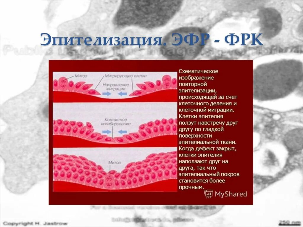 Эпитализация. Эпитализация
