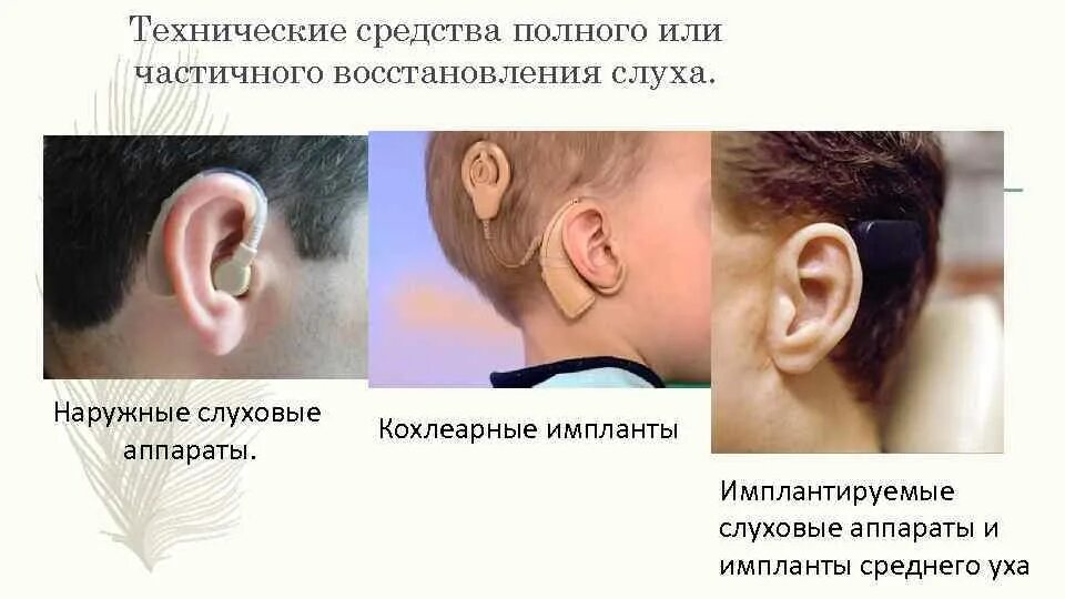 Нарушение слуха. Технические средства реабилитации при нарушении слуха. Методы реабилитации слуха. Технические средства кохлеарной имплантации. Нарушения слуховых функций