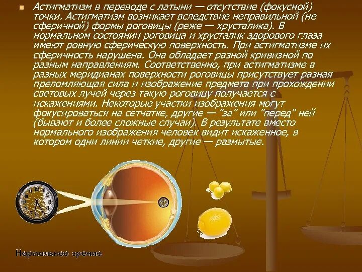 Хрусталиковый астигматизм. Астигматизм хрусталика. хрусталиковый астигматизм возникает вследствие. реже роговицы хрусталика астигматизм. астигматизм отсутствие (фокусной) точки.