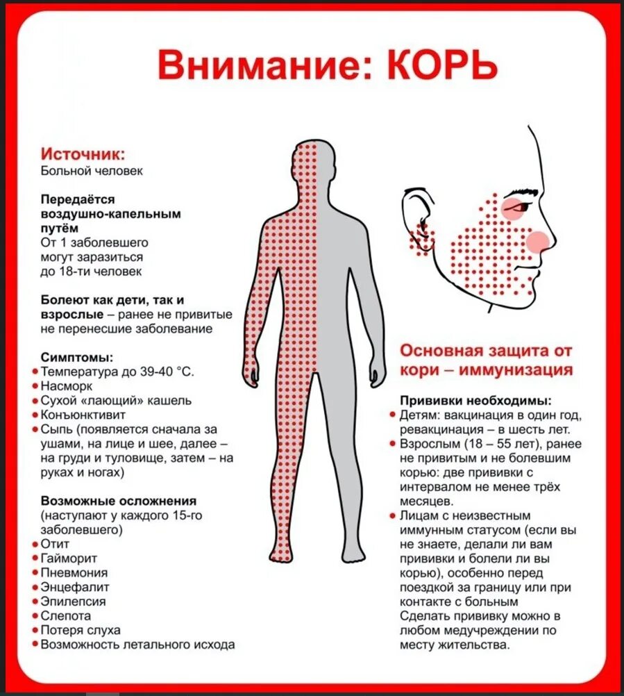 Осложнения кори у взрослых. Инфекционное заболевание корь.