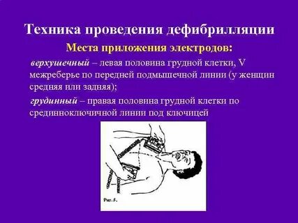 Техника проведение