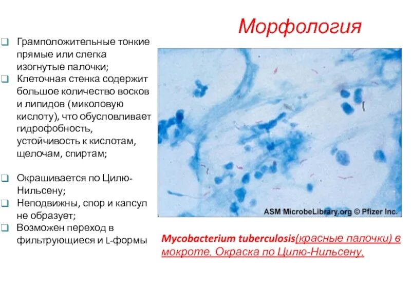 Мокрота окраска. Mycobacterium tuberculosis в мокроте окраска по Цилю Нильсену. Микобактерии туберкулеза по Циля-Нильсена. Микобактерия туберкулеза по Цилю Нильсену. Микобактерии туберкулеза микроскопия по Цилю Нильсену.