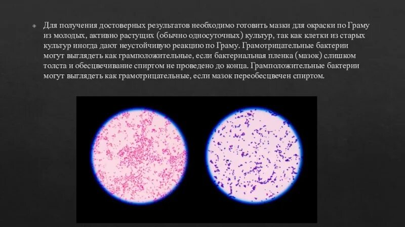 Окраска спор бактерий. Окраска бактерий. Метод окраски бактерий по Граму. Метод окрашивания спор бактерий. Методы окраски микроорганизмов.