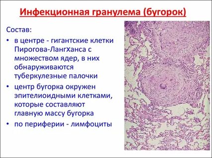 Гранулез