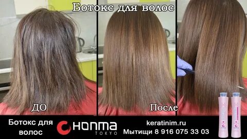 Ботокс после гв