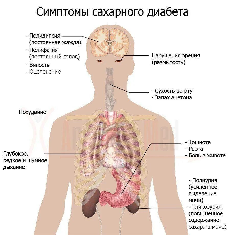 Основные симптомы при сахарном диабете. Симптомы сахарного Диаб. Симптомы сахпрногодиабета.