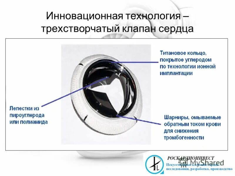 Митральный клапан трехстворчатый клапан. Механический протез аортального клапана МЕДИНЖ 25. Трехстворчатый аортальный клапан сердца. Протез митрального клапана. Как клапан делает операция