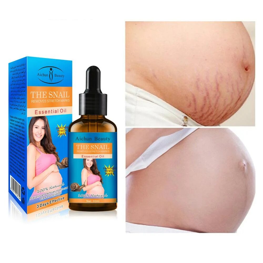 Stretch Marks крем от растяжек. Anti stretch Mark Cream для беременных. Масло для тела для беременных от растяжек. Lan be na stretch Marks removing Oil.