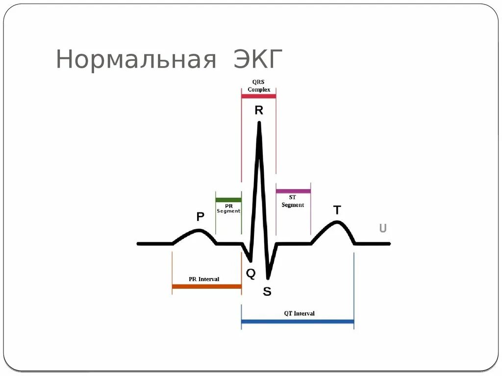 Кардиограмма норма. Нормальный график экг. электрокардиография нормальная экг. схема экг в норме. экг снимок норма.
