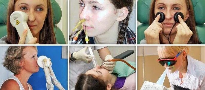 Как прогреть нос