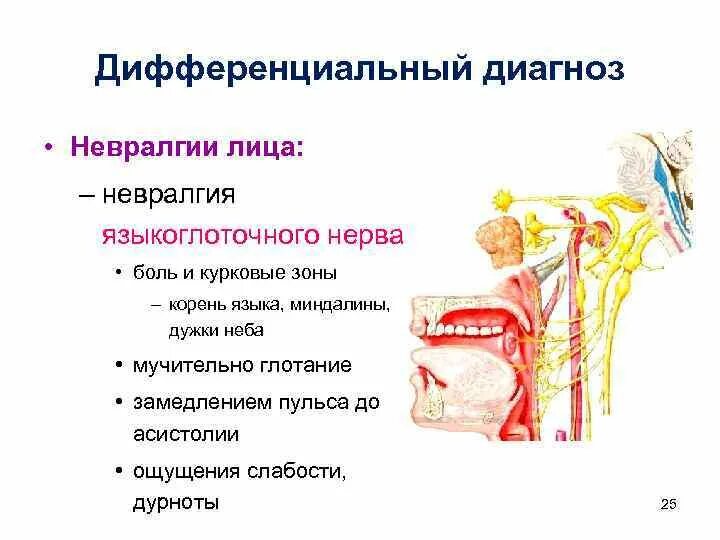 Поражение языкоглоточного нерва. Симптомы поражения языкоглоточного нерва неврология. Нарушение языкоглоточного нерва симптомы. Невралгия языкоглоточного нерва этиология. Повреждение языкоглоточного нерва симптомы.