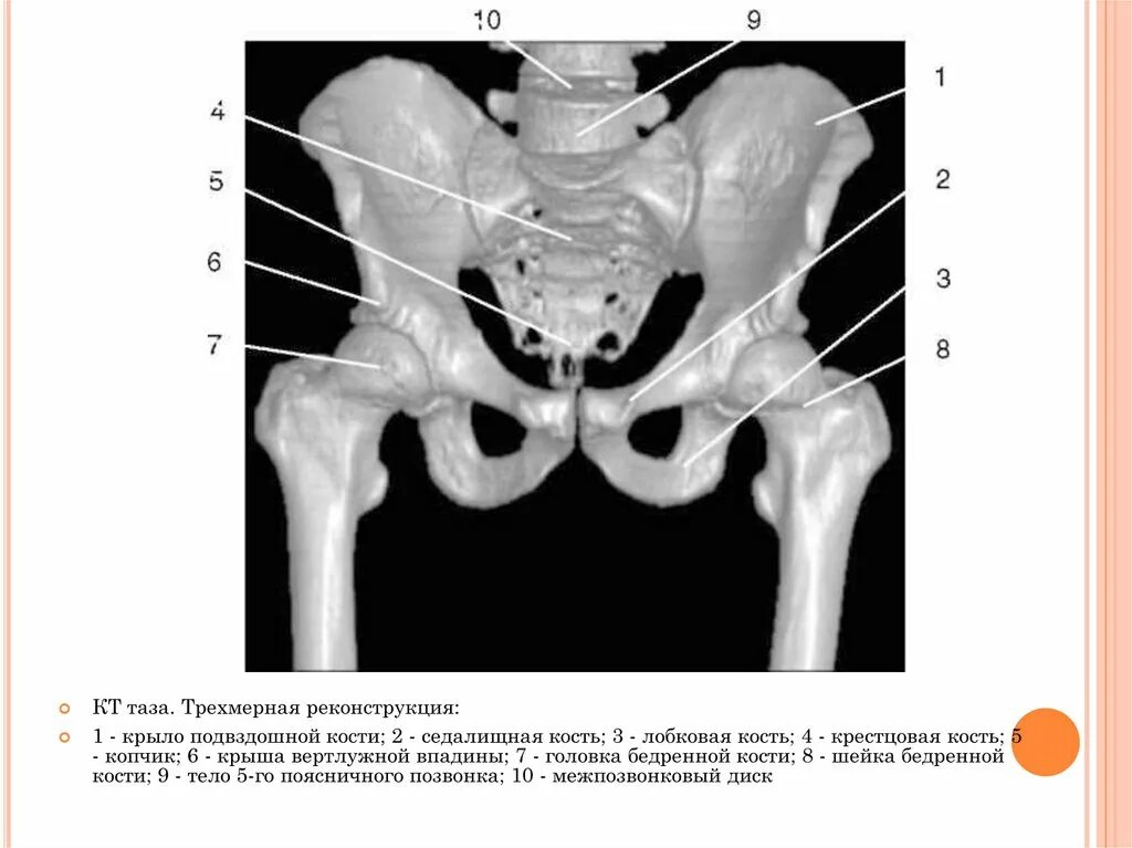 Передние ости подвздошных костей. Седалищная кость рентген анатомия. Подвздошная кость таза анатомия. Подвздошная кость рентген анатомия. Кости таза анатомия рентген.