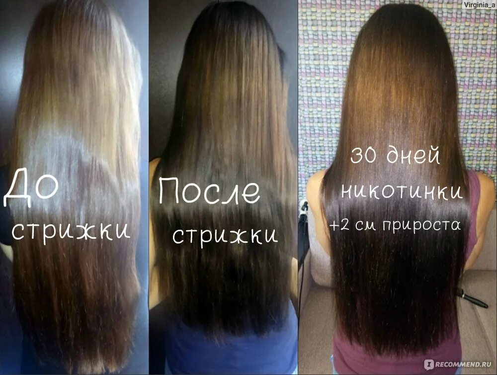 Никотиновая кислота для волос. Никотиновая кислота для волос рост волос. Волосы после никотиновой кислоты. Никотиновая кислота для волос до и после.