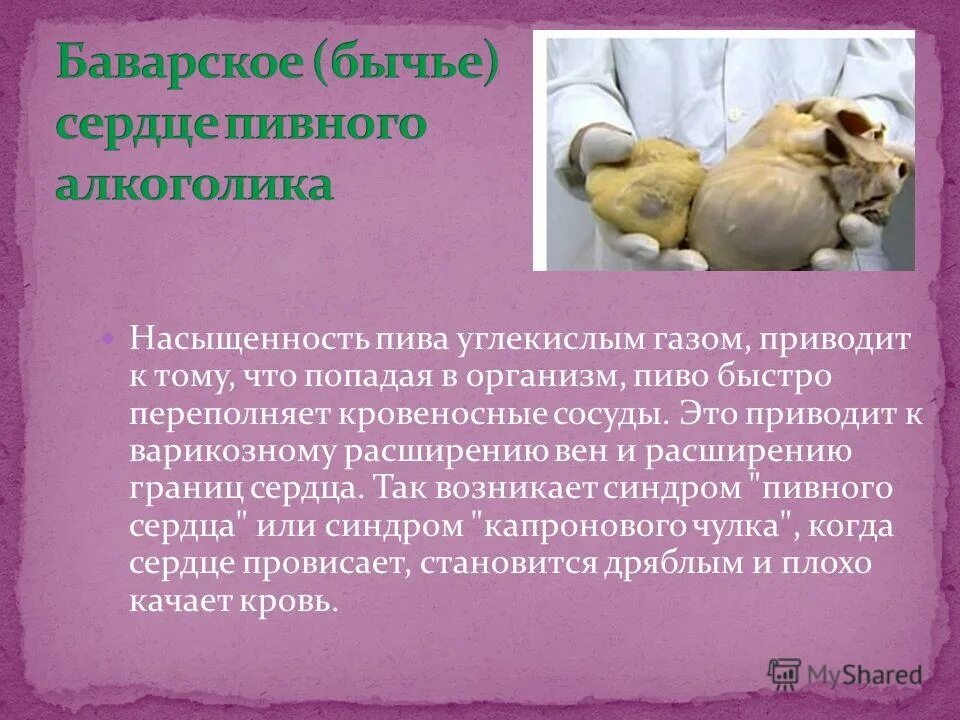 бычье сердце болезнь рентген. гипертрофия миокарда, бычье сердце. сердечная недостаточность перкуссия. бычье сердце диагноз у человека что это. бычье сердце пиво.