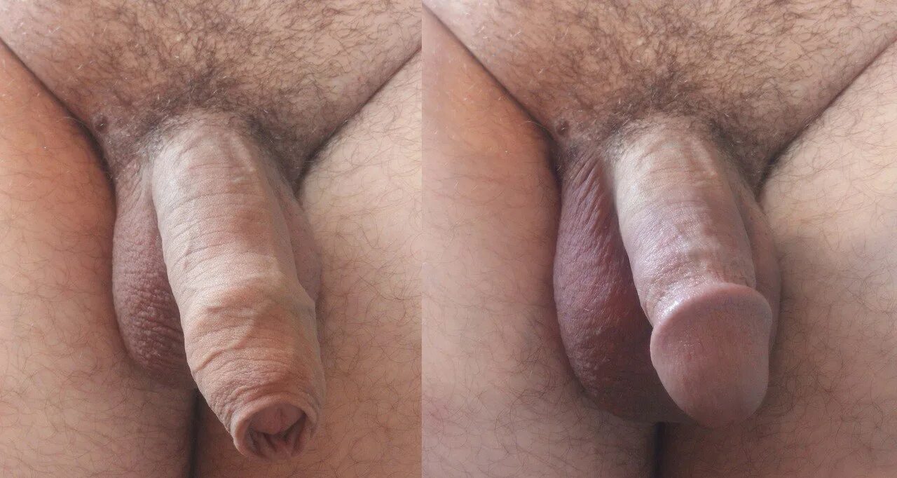 Затянулся Пенис