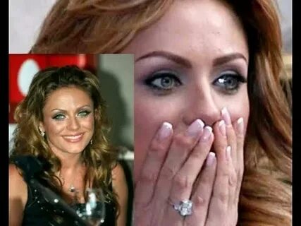Подагра признаки на руках началова руки