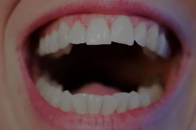 Сонник выпал передний зуб без крови. Приснился отколотый зуб. Приснилось что откололся кусочек переднего зуба. К чему снится выпадение передних зубов.