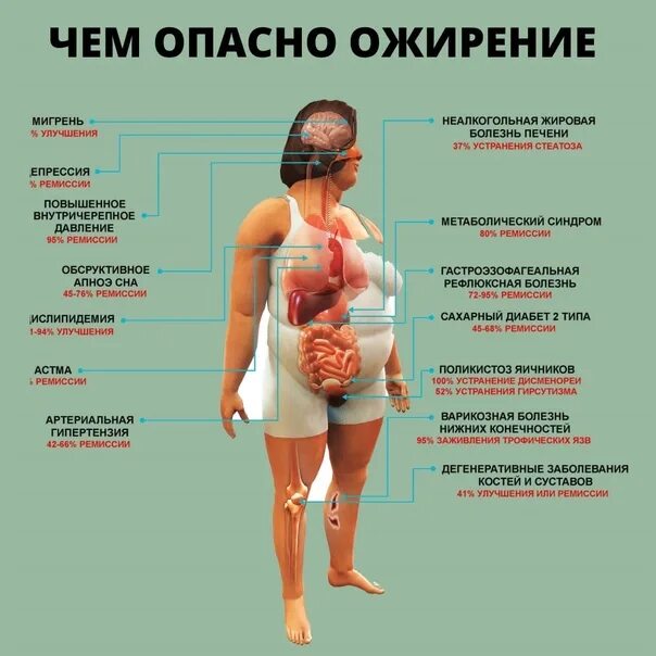 К чему приводит ожирение. К чему приводит ожирение