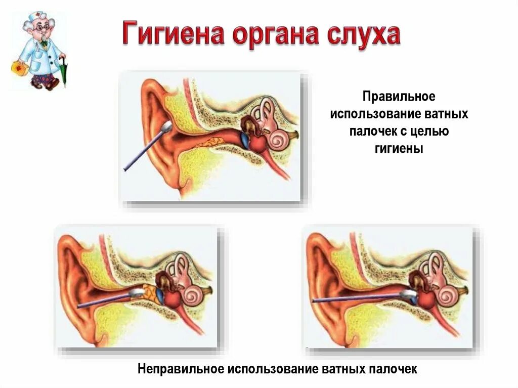 Гигиена органа слуха 8 класс. Слуховой анализатор гигиена слухового анализатора. Гигиена ушей человека 8 класс. Гигиена слухового анализатора 8 класс. Гигиена слуховой анализатор 8 класс биология.