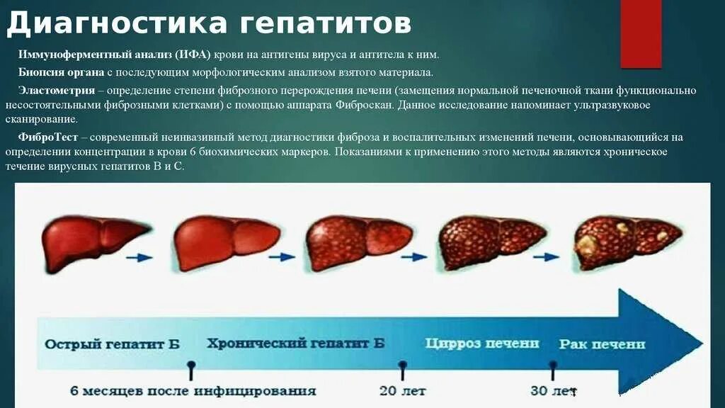 Бассейн гепатита. Вирусное поражение печени. Гепатит а поражение печени. Печень пораженная гепатитом.