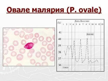 Трехдневная малярия