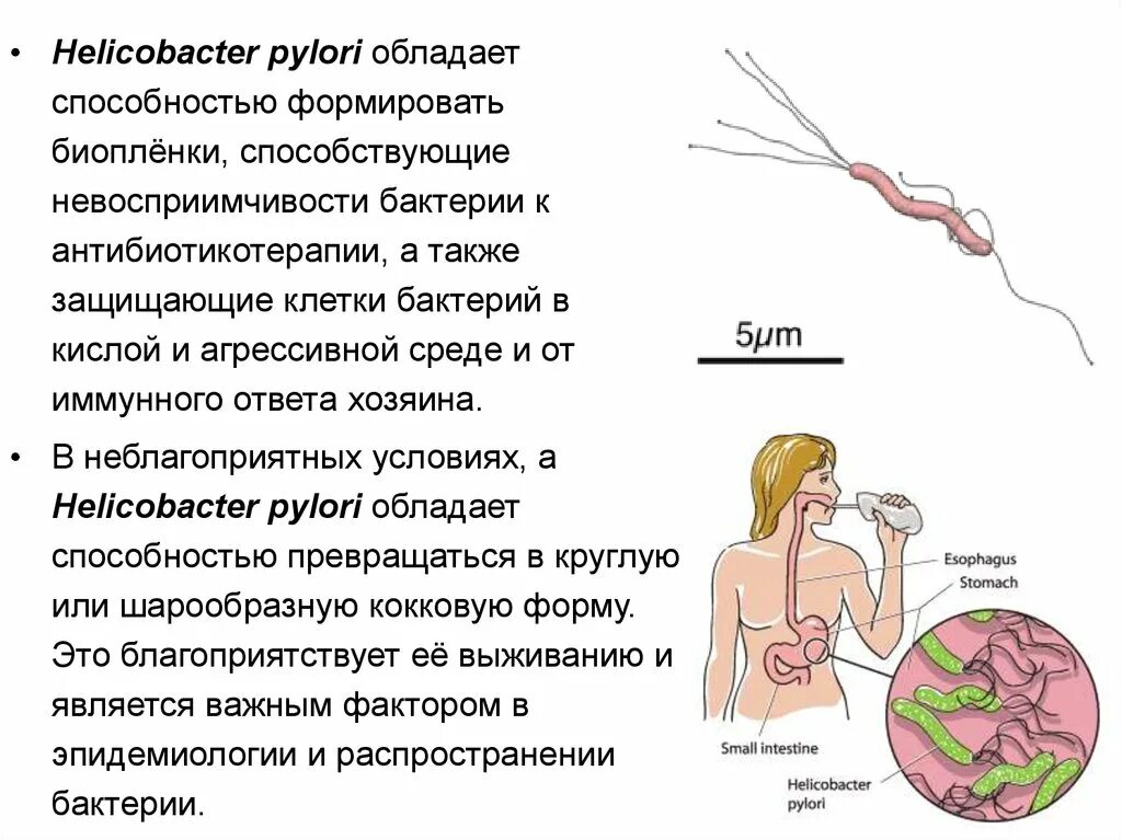 Признаки заражения Helicobacter pylori. Хеликобактер пилори язвенная болезнь. Язва желудка хеликобактер. Хеликобактер пути заражения симптом. Как передается язва