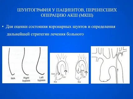 Операция перенос