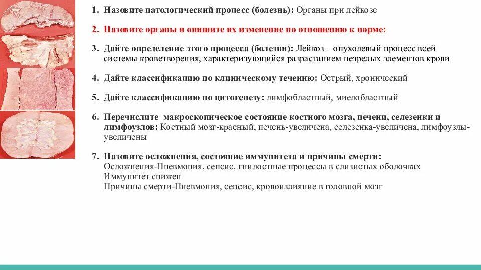 Назовите патологических процессов. Патологический процесс при котором увеличивается орган. Патологические процессы при лейкозе. Изменения органов при лейкозе. Изменения во внутренних органах при лейкозах.