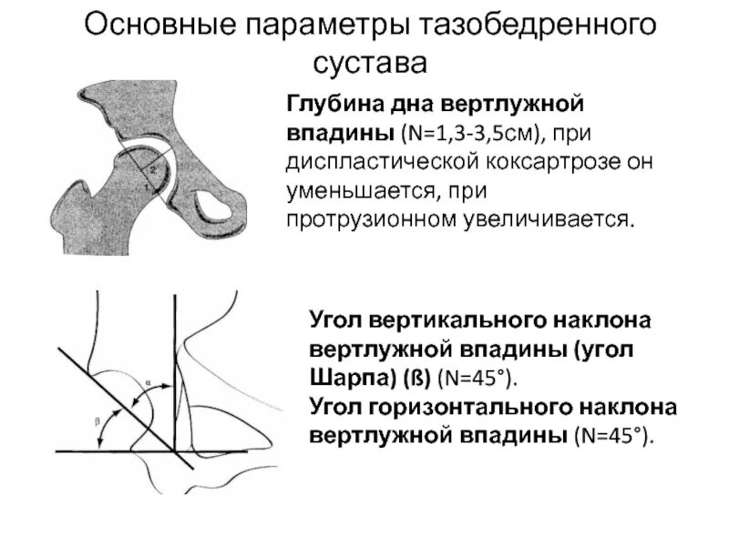 Угол вертикального соответствия тазобедренных суставов норма. Дисплазия вертлужной впадины тазобедренного сустава рентген. Угол вертикального наклона вертлужной впадины Шарпа. Протрузия вертлужной впадины тазобедренного сустава.