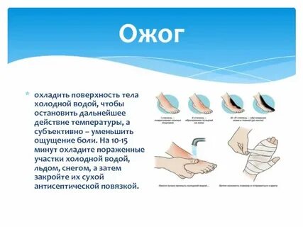 Обжег водой