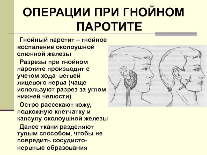 Воспаление околоушной железы. Восраление околокшной слбнной железы. Воспаление околоушной слюнной железы. Воспалилась околоушная слюнная железа. Операции околоушная железа