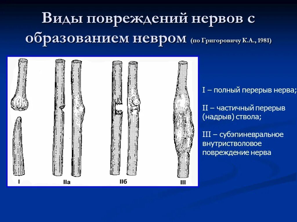 Формы повреждений нервов. Виды повреждения нервов. Повреждение периферических нервов.