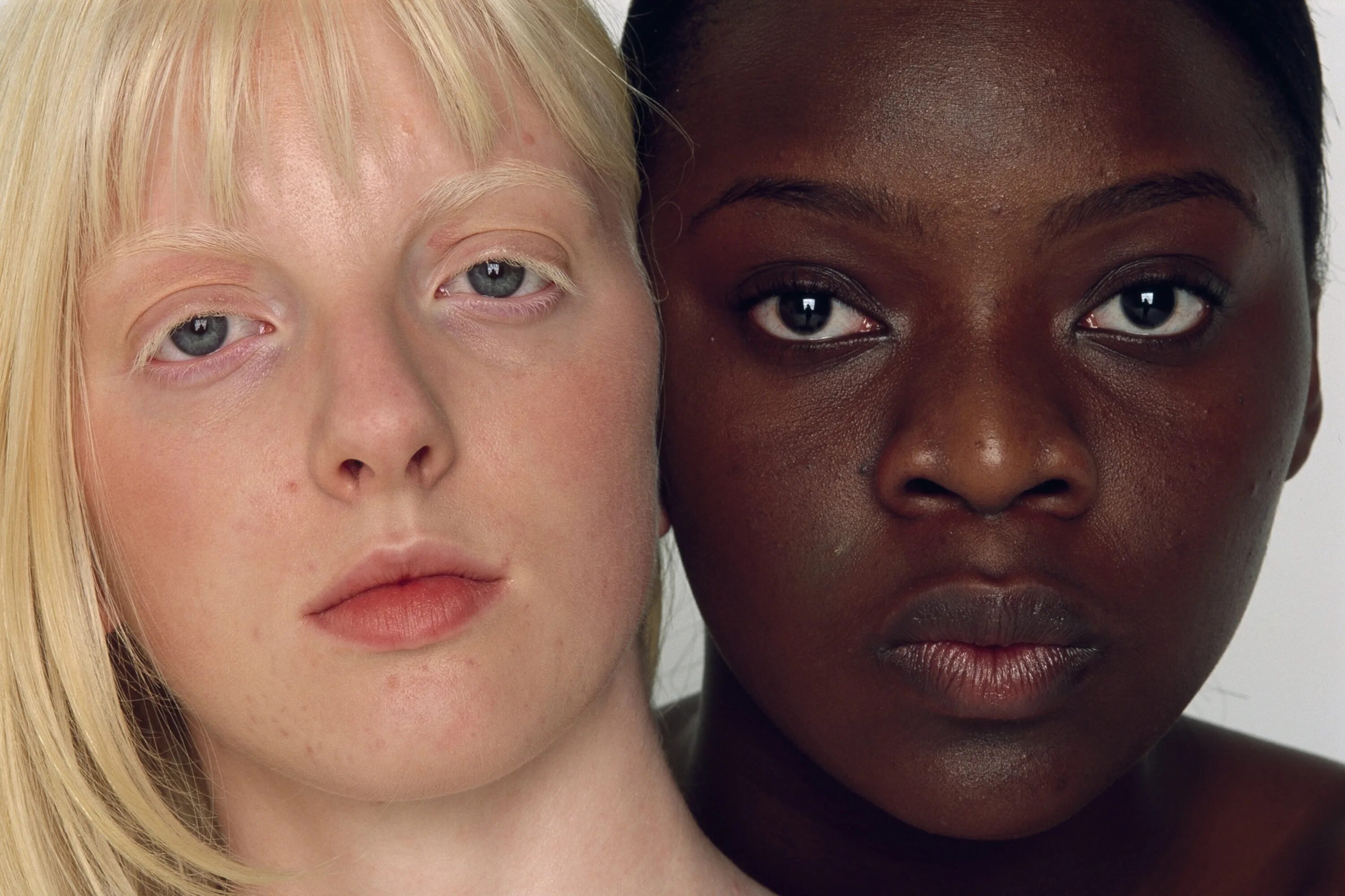 Девушка с чистой кожей. Анастасия жидкова альбинос. Wait skin. Thaliwhite skin tone brightening fluid. Wait skin.