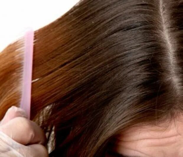 Перекись от вшей и гнид. Чемеричная вода от педикулеза. Перекись от вшей и гнид. Перекись водорода от вшей. Перекись водорода от вшей.