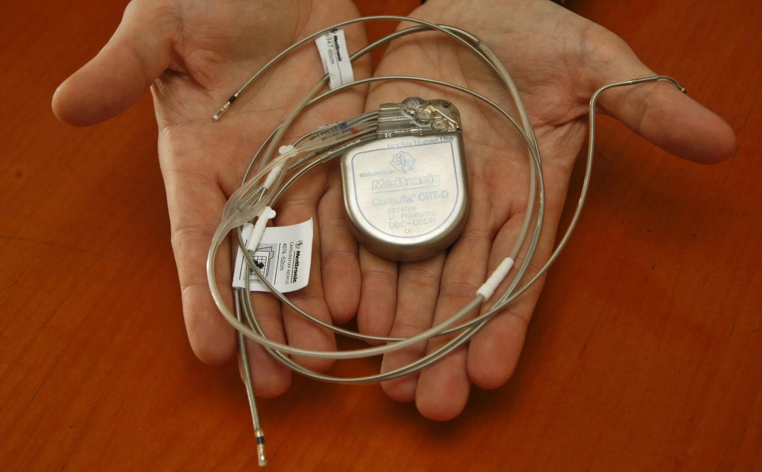 Если стоит кардиостимулятор можно. Кардиостимулятор трехкамерный Medtronic. Имплантируемые кардиовертеры-дефибрилляторы. Кардиовертер-дефибриллятор имплантируемый трехкамерный. Имплантируемый кардиостимулятор.