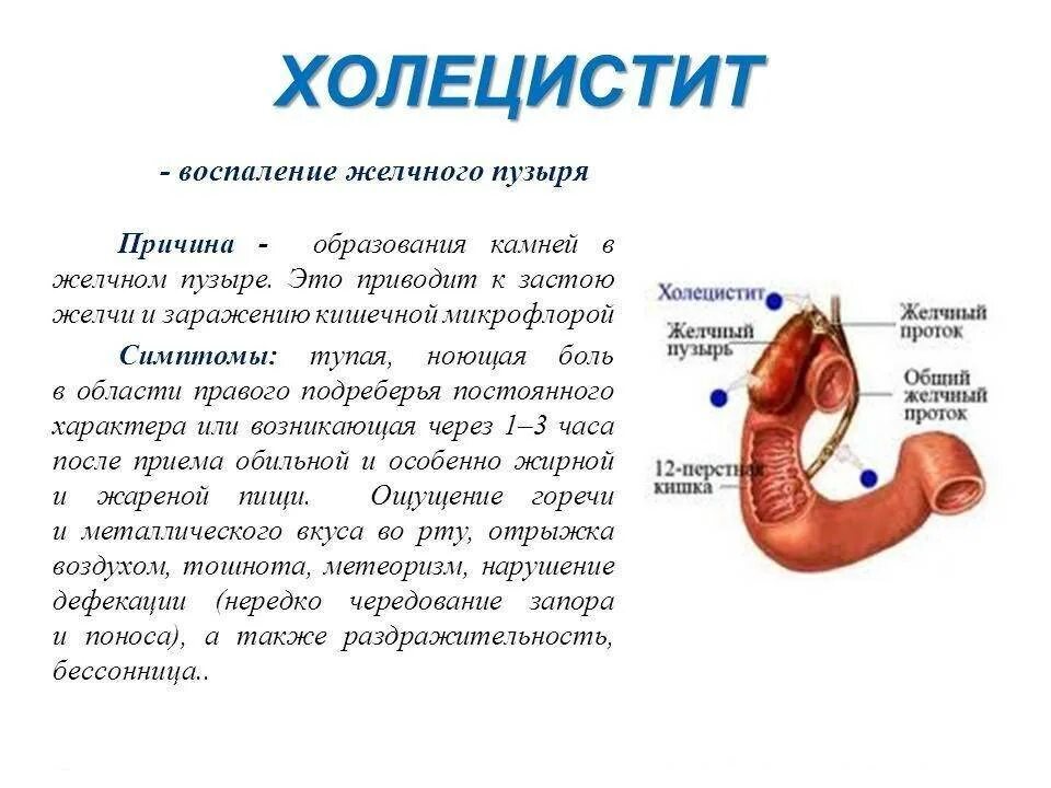 Воспаление желчного пузыря. Холецистит воспаление желчного пузыря