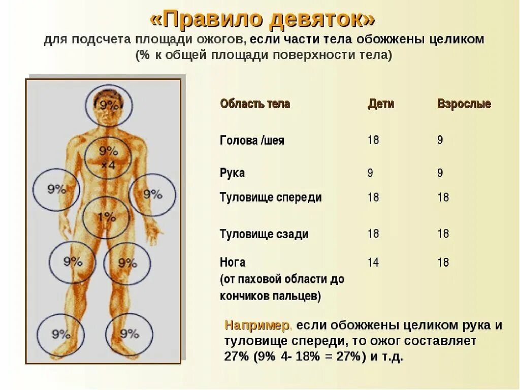 Ожоги проценты поражения. Определение ожоговой поверхности методом 9. Площади ожога у взрослых по правилу девяток. Площадь ожога передней поверхности туловища.