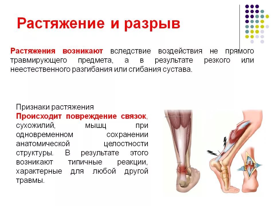 Симптомы растяжения и разрыва связок. Растяжения, повреждения связок.. Растяжение и разрыв связок признаки. Растяжение связочного аппарата ноги.