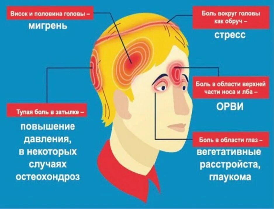 Начинает болеть голова что делать. Головная боль. Боль в голове. Типы головной боли. Боль в голове при стрессе.