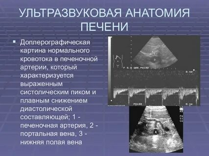 Узи печени описание
