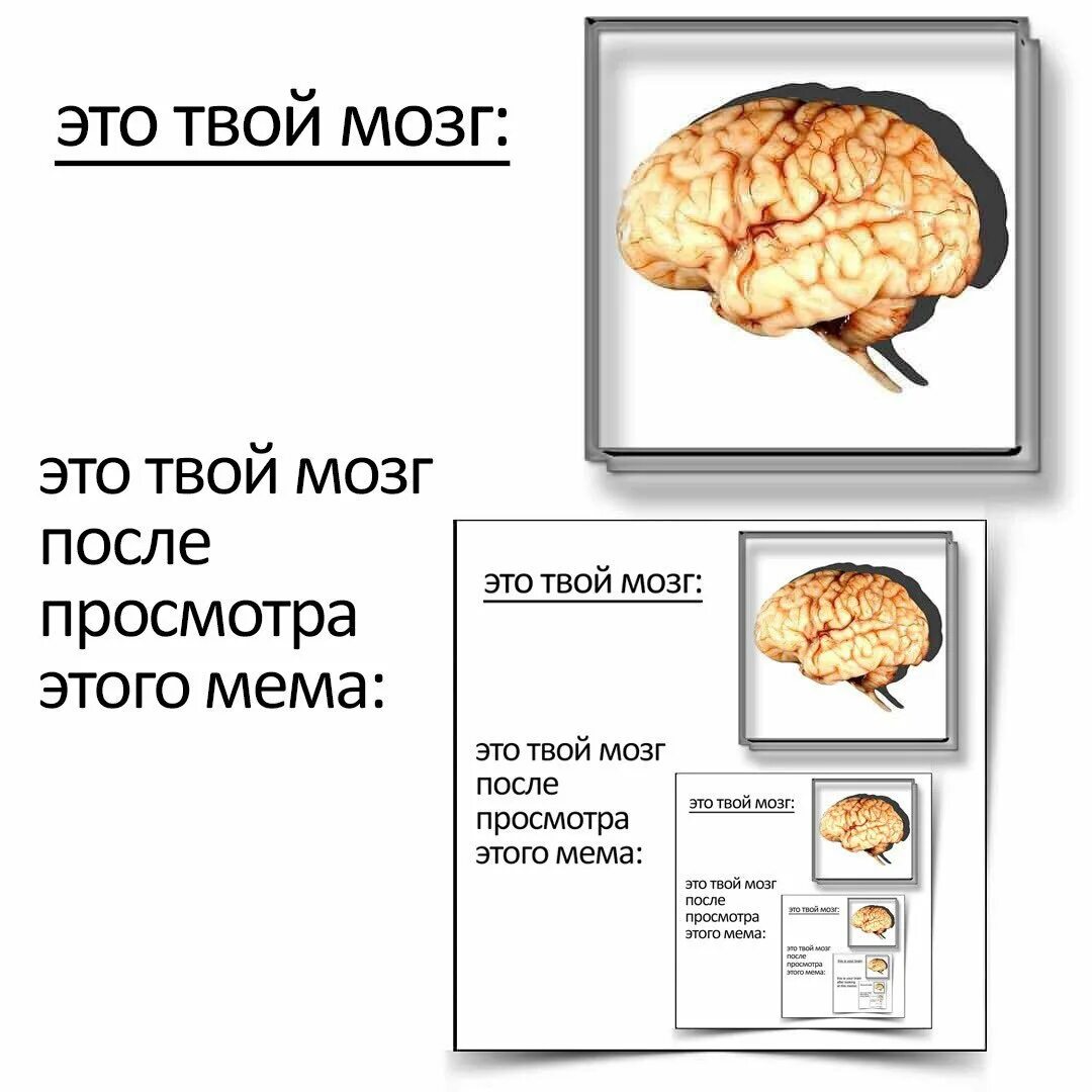 Мозг какого рода