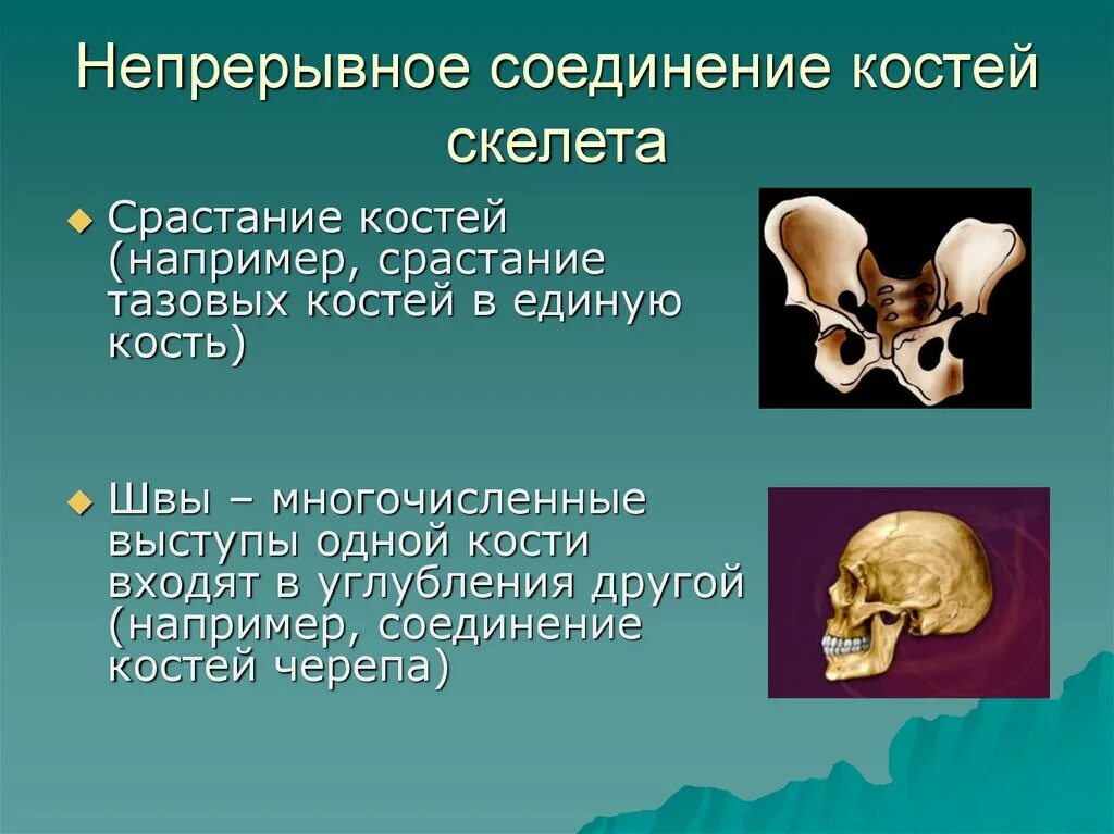 Типы соединения костей 8 класс. Неподвижное соединение костей. Непрерывные соединения костей. Соединение скелета головы.