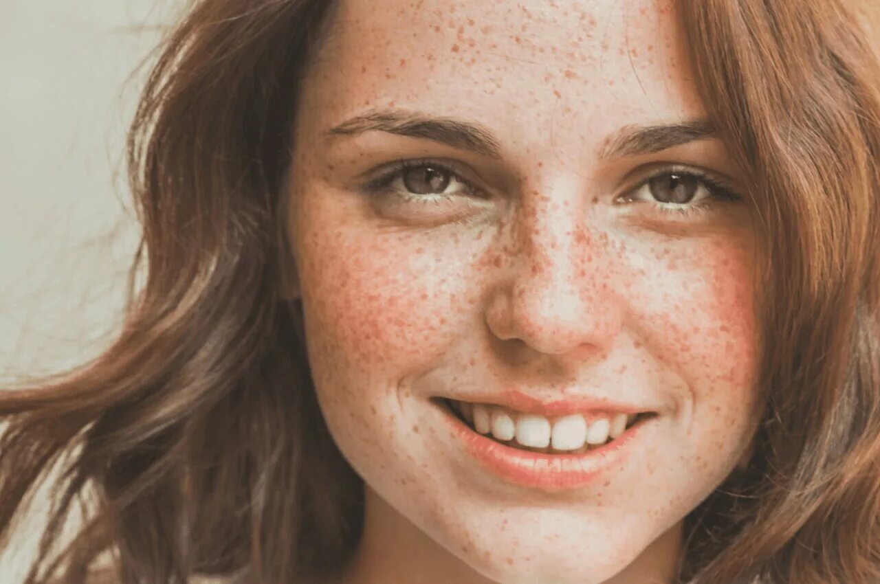 Freckles перевод. Девушка с веснушками. Кожа с веснушками. Веснушки на лице.