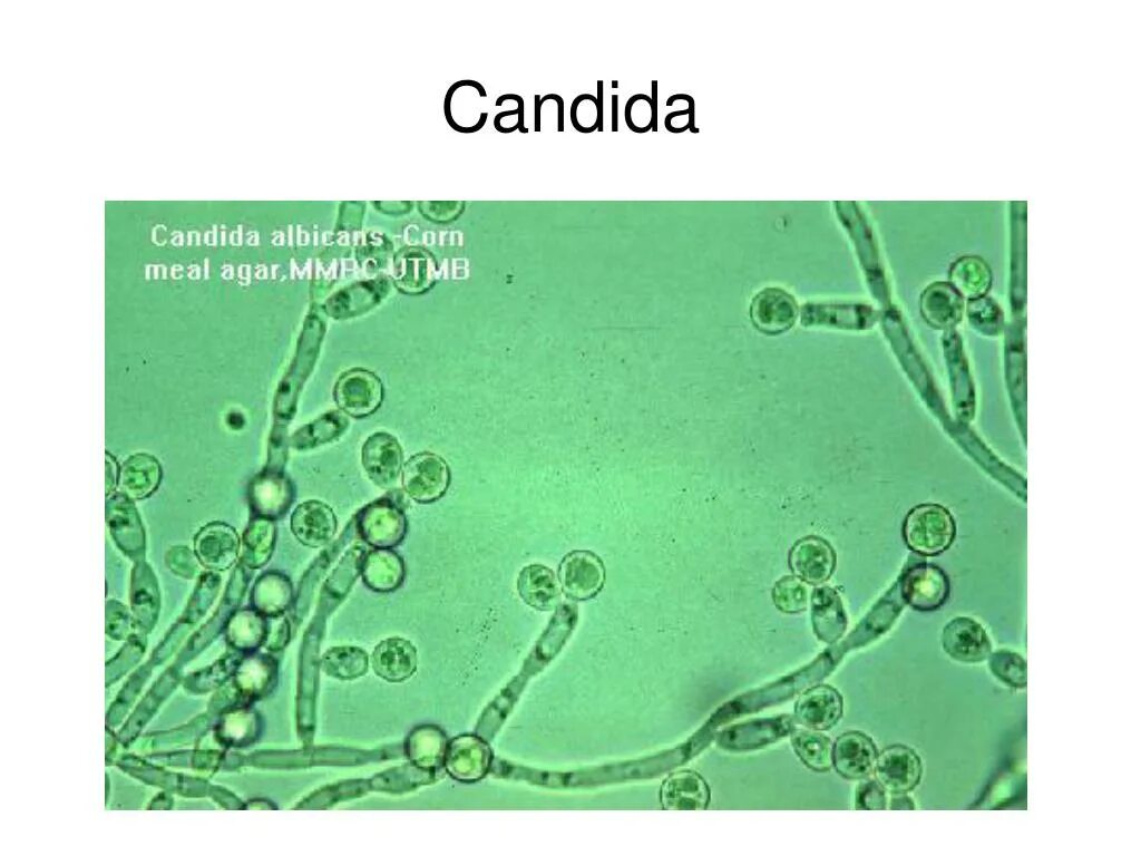 Споры candida. Грибы рода кандида альбиканс. Дрожжеподобные грибы рода Candida. Грибы кандида альбиканс морфология. Грибы кандида микроскопия.