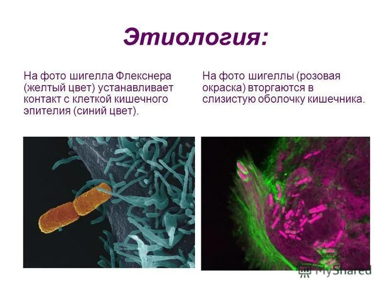 Шигеллы вызывают заболевание. Возбудитель дизентерии Флекснера. Шигеллы Зонне и Флекснера. Шигеллез Флекснера. Шигеллы дизентерии.